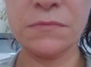 Kosmetikstudio Rottweil & Oberndorf am Neckar mit effektiven Behandlungen