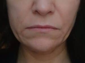 Kosmetikstudio für Rottweil und Oberndorf am Neckar mit hochwertigen Kosmetikbehandlungen