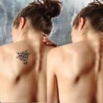 Tattoo entfernen Tattooentfernung Balingen Rottweil Villingen-Schwenningen