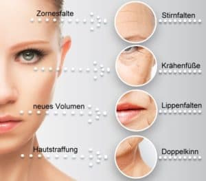 Doppelkinn entfernen im Kosmetikstudio Rottweil besser als Ultraschall und Microdermabrasion