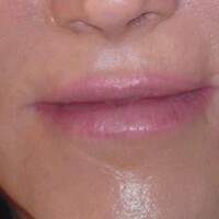 Lippenkorrektur Permanent Make up