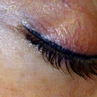 Permanent Makeup entfernen Oberndorf Villingen-Schwenningen Bad Dürrheim