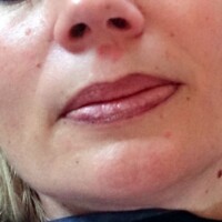 Entfernung Permanent Make-up Sulz am Neckar Donaueschingen Oberndorf