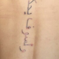 Tattoo lasern Rottweil Villingen-Schwenningen Albstadt-Ebingen