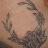 Tattooentfernung Tattoo entfernen Rottweil Balingen Albstadt-Ebingen