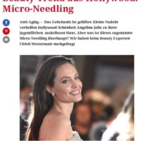 Microneedling Rottweil und Dermaroller