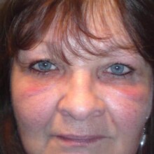 Permanent Make up balingen lidstrich