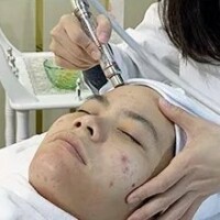 Cold Hammer Behandlung