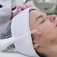 Hydra Dermabrasion