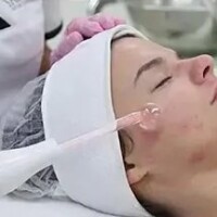 Hydra Dermabrasion