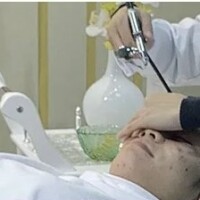Hyaluron Behandlung microdermabrasion