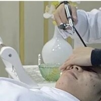 Hyaluron Behandlung microdermabrasion