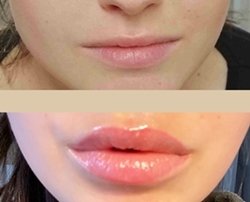 Permanent Make up Lippen